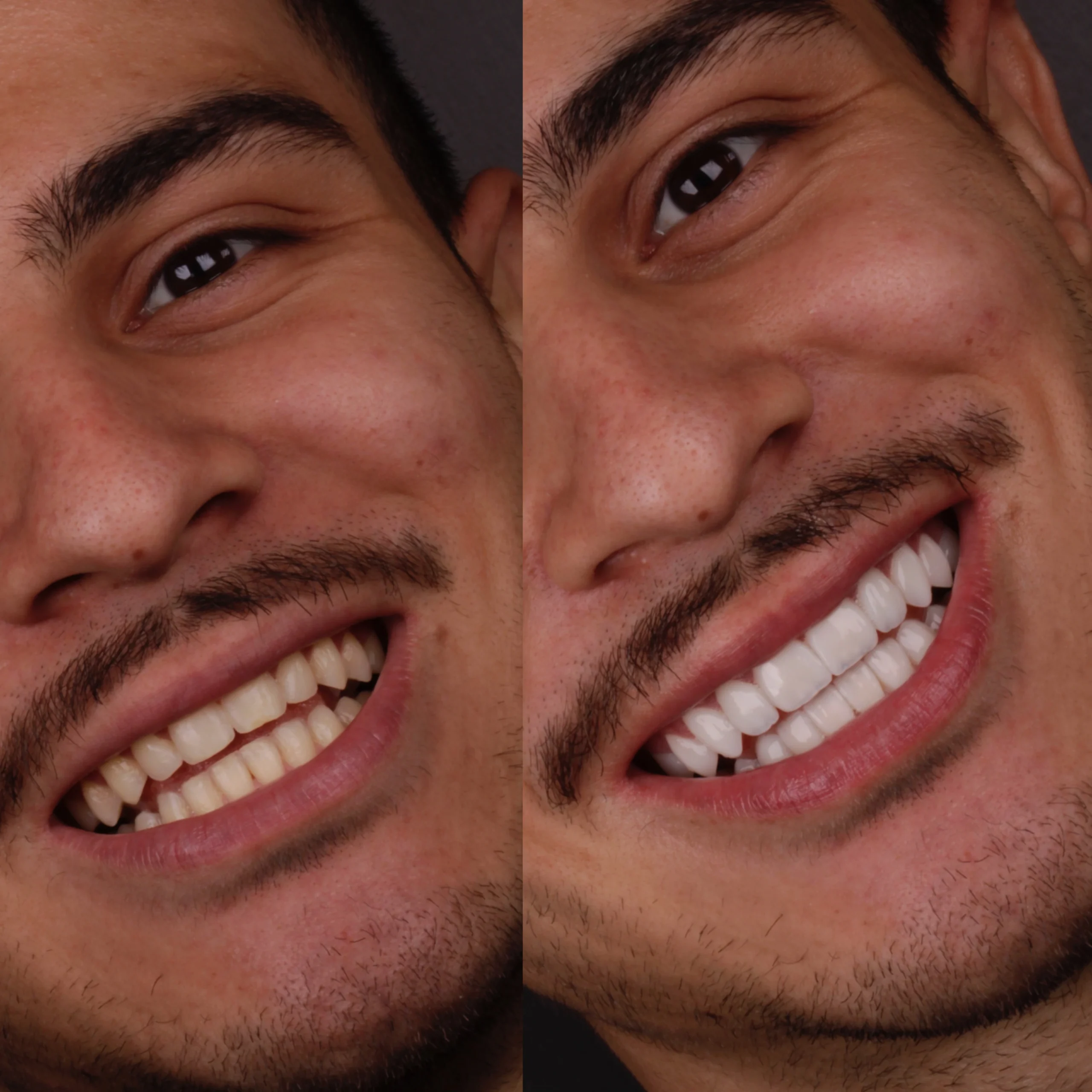 photo-output (9)